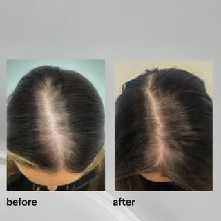 🌱 HAIR RESTORATION — START WITH YOUR SCALP

Hair concerns can be frustrating, especially when you'v