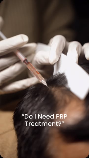 Your skin has its own repair kit. We just know how to activate it.

PRP uses your own platelets to s
