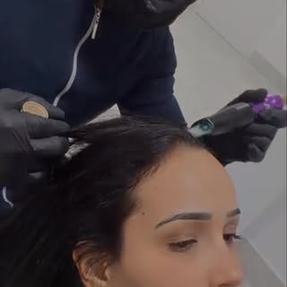 Estamos fazendo um tratamento capilar no cabelo da @lorenacastrooo com exossomos, fatores de crescim