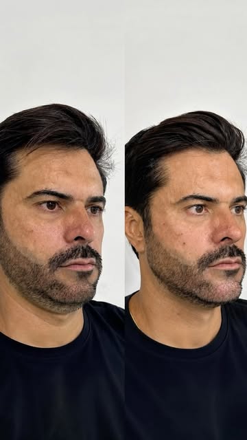 Harmonização facial é sobre equilíbrio, proporção e valorização dos traços.

Aqui, o visagismo direc