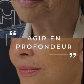 ✨ Ce que vous voyez n’est qu’une partie du problème.
Parce que l’essentiel est invisible.
Les rides,