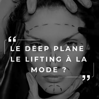 Le Deep Plane n’est pas une tendance.

On en parle beaucoup en ce moment, souvent comme d’une nouvea