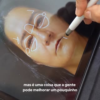 Vou mostrar o protocolo completo dessa paciente! 👁️✨
Ela já fez blefaroplastia superior, mas ainda 