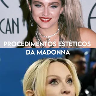 Quais procedimentos estéticos a Madonna já realizou?
Não sabemos ao certo. Mas nesse vídeo eu tento 