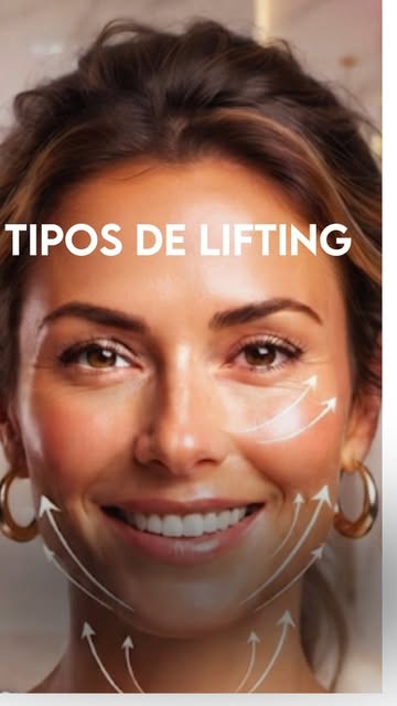 Mini lifing,deep plane, lifting cervical. Você ja ouviu falar, mas conhece o que cada um deles faz?
