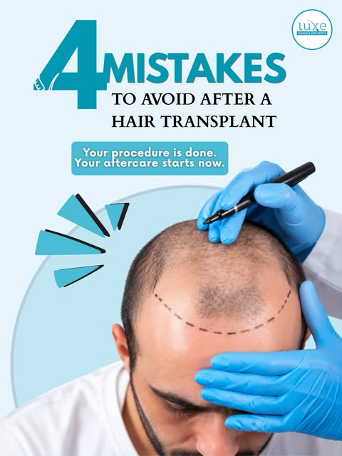 Got a hair transformation? Don’t make these 4 mistakes! 🚫💇‍♂️

Your hair transplant is only the be