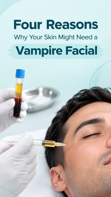Vampire Facial: your skin’s natural glow-up!

Using your own platelet-rich plasma (PRP), this treatm