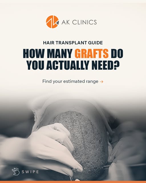 Your friend needed 4,000 grafts. Does that mean you do too? 🤔

Your hairline, donor area and covera
