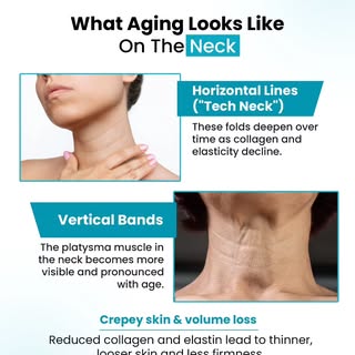Your neck often shows the earliest signs of ageing. Fine horizontal lines, visible neck bands, and l