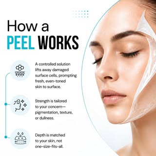 Healthy skin starts with the right treatment, tailored to your skin. A chemical peel gently removes 