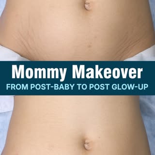 ✨Motherhood changes your body. Your confidence doesn’t have to change with it.

Every pregnancy leav