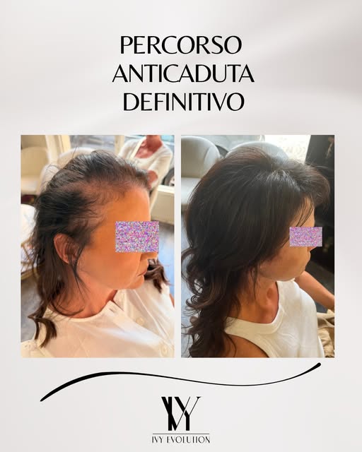 Daniela ha affrontato insieme a noi il suo percorso fino al giorno del suo matrimonio 🤍

Le immagin