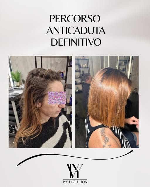 PRIMA E DOPO.
Questo è quello che succede quando una cute non sana torna equilibrata. 🌿
L'intera ch