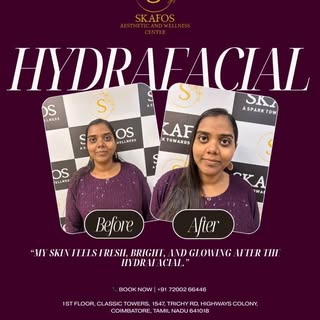 From dull ✖️ dehydrated ✖️ tired skin
to clean, hydrated, glowing skin ✨

This is the HydraFacial tr