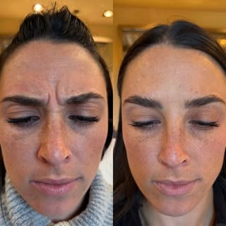 Relaxed and refresh’d.

Results are two weeks apart.