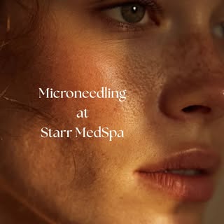 Curious about microneedling but not sure what to expect? ✨

We’re breaking down the process—from pre
