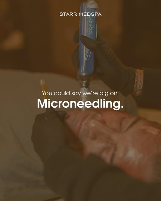 With over 1,000 treatments performed in the past year alone, we’ve had a lot of time with a SkinPen 