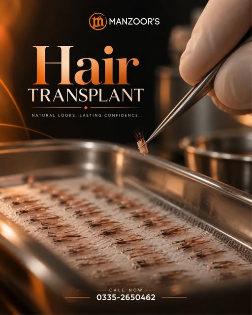What if the secret to a natural-looking hair transplant isn’t just how many grafts you receive—but w