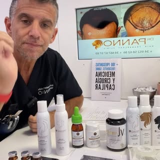 Vivo sobre tratamientos médicos contra la alopecia  con espe