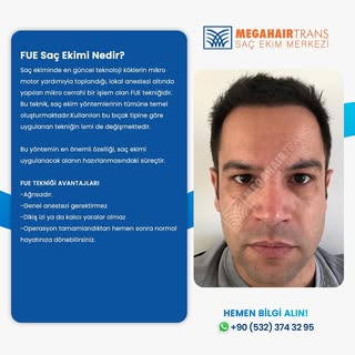 FUE Saç Ekimi Nedir? Avantajları…

Değişiminiz Saçlarınızda Başlasın ...! Sizleri Kliniğimize Be