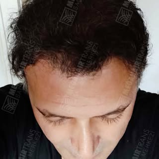 Değişiminiz Saçlarınızda Başlasın ...! Sizleri Kliniğimize Bekliyoruz.

“ YILIN EN İYİ SAÇ EK