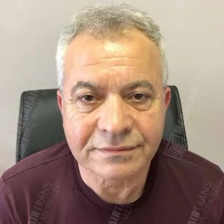 Değerli Hastamıza Saç Ekimi Yapılmıştır. Hastamızın Muhteşem Değişimi...

Değişiminiz Saçlar