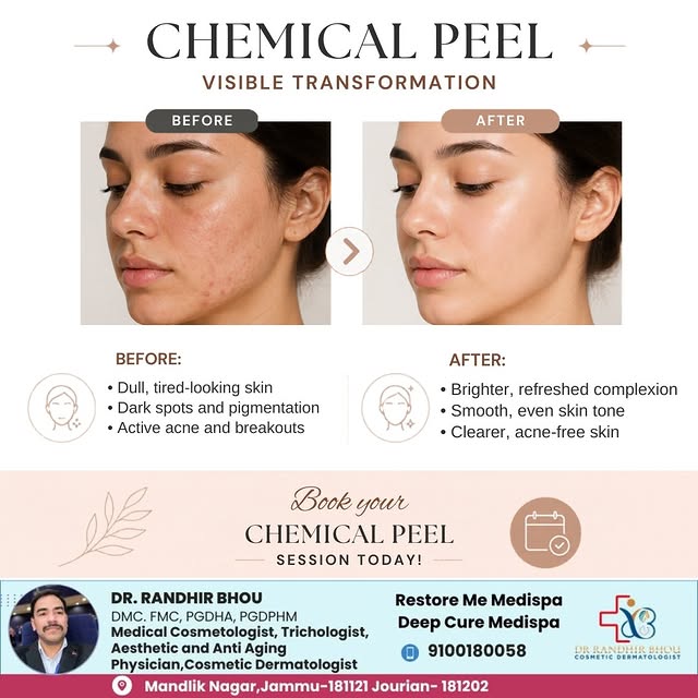 Chemical peels offer a visible transformation for your skin by helping to improve the appearance of 