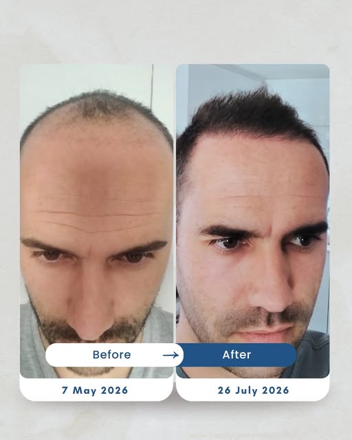 A big thank you to Werne, for sharing these photos of the early stages of his transplant recovery 🌱