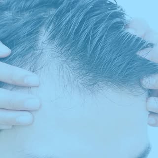 Losing your hair or only takes a physical toll on ones body, but their emotional and mental health a