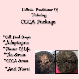 "Growing Hair Is Our Priority * Call today for your Consultation!  #hairlosspractitioner, #tricholog