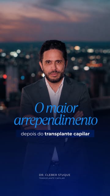 Muitos pacientes passam anos tentando disfarçar a calvície e, depois do transplante, fazem a mesma p