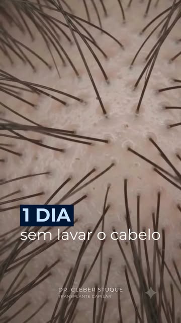 Um dia sem lavar pode não parecer nada. Dois, três, quatro dias já podem mudar bastante o couro cabe