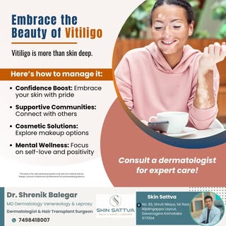 Vitiligo is more than a condition-it's about embracing your unique beauty. Boost your confidence, jo