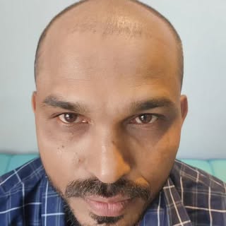 Losing hairs shouldn't be an obstacle for finding a match!
This young man came with a lot of hope to
