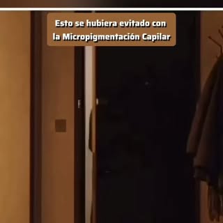 Micropigmentación Capilar
Isabel Gómez, Alicante
WhatsApp 667 640 118

Esto se podia haber evitado s