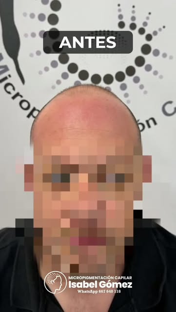Micropigmentación Capilar
Isabel Gómez, Alicante
WhatsApp 667 640 118

Dos sesiones y un gran cambio