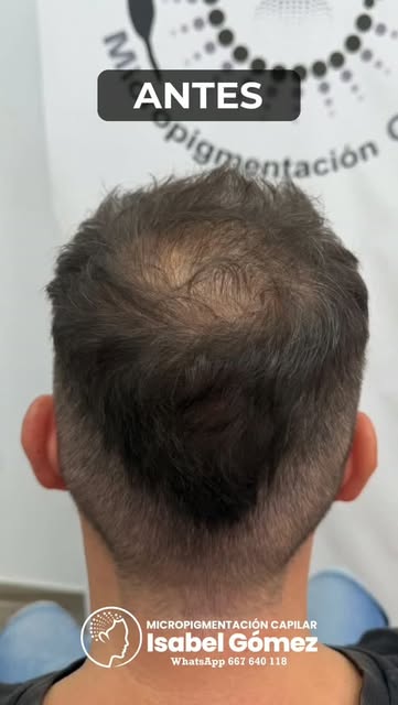 Micropigmentación Capilar
Isabel Gómez, Alicante
WhatsApp 667 640 118

Falta de  densidad??, un par 