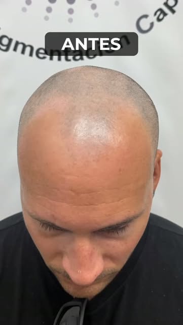 Micropigmentación Capilar
Isabel Gómez, Alicante
WhatsApp 667 640 118

Hay veces que una decisión te