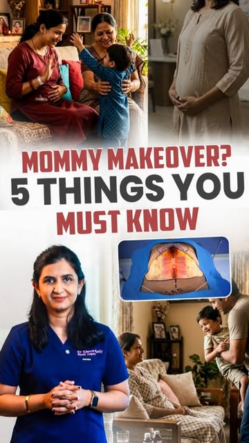 Thinking about a mommy makeover? Before you book that surgery date, here are 5 things you need to se