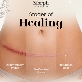Your skin’s healing journey happens in stages ✨

After any skin procedure or surgery, healing is a n