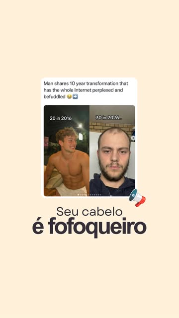 O estresse que você está vivendo hoje talvez só apareça no espelho daqui a dois ou três meses. 👀

_