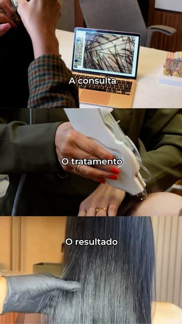 Consulta, tratamento e resultado ✨🤍