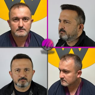 ✨ Profesyonel & Güven Veren Tarz:

Öncesi ve sonrası farkıyla karşınızdayız!
Doğru planlama, uzman e