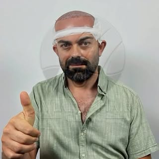 Wealth Hair Clinic’te her saç ekimi;
yüz yapısı, saç çizgisi ve beklentiler dikkate alınarak
kişiye 