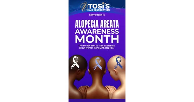 Deep blue for solidarity. Soft browns for strength. 💙🤎 This Alopecia Areata Awareness Month, we’re