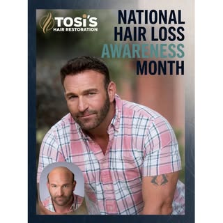 National Hair Loss Awareness Month is a reminder that education, understanding, and support can make