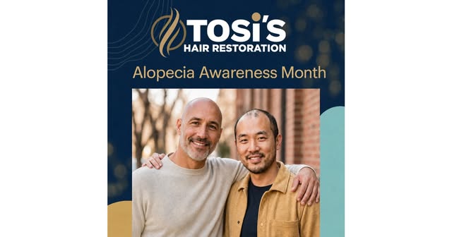 Two smiles. One message: no one should face alopecia alone. 💛 During Alopecia Awareness Month, Tosi