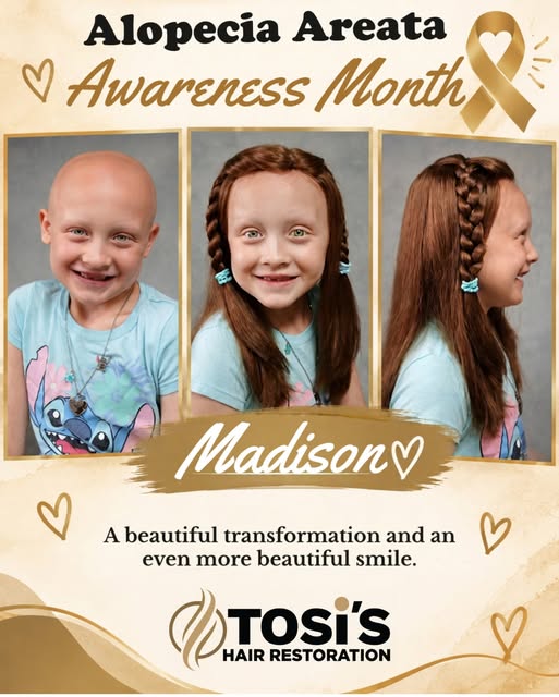 Meet Madison and celebrate her beautiful transformation—and the smile that shines through it all. 💜