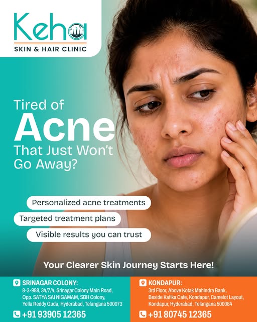 Tired of stubborn acne that just won’t go away no matter what you try? 😩 

🌱 Stop letting breakout