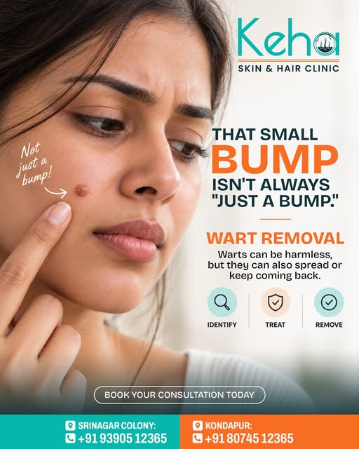🔍 That Tiny Bump Might Deserve a Closer Look! ✨

Not every skin bump is the same. Warts can sometim